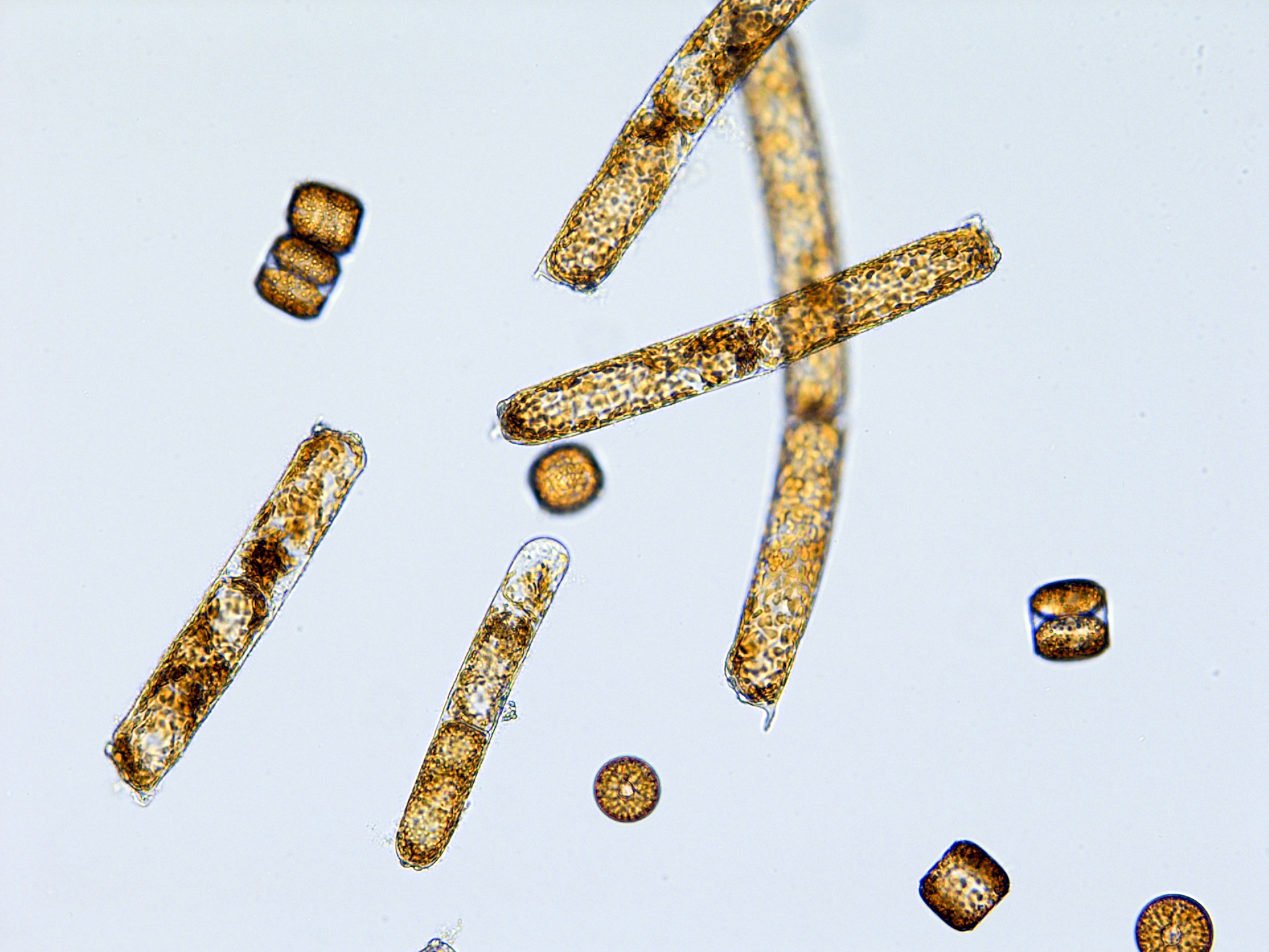 RS4616_GW_odontella_erc_Image003-alt.jpg
